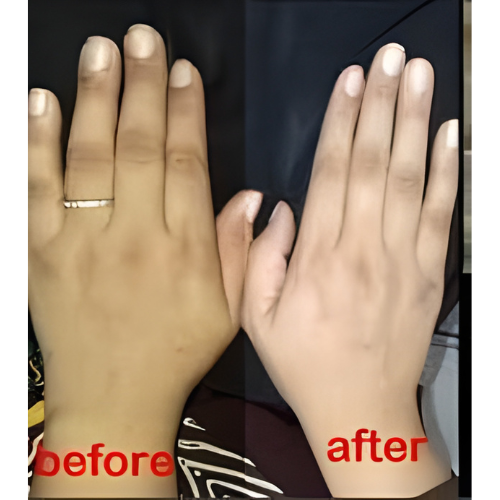 🚨MEGA SALE! Zafrani Glow Cream [FREE HOME DELIVERY]  🔥